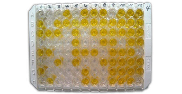 Rys.1 Pośredni test ELISA do wykrywania przeciwciał przeciwko Chlamydii w surowicy