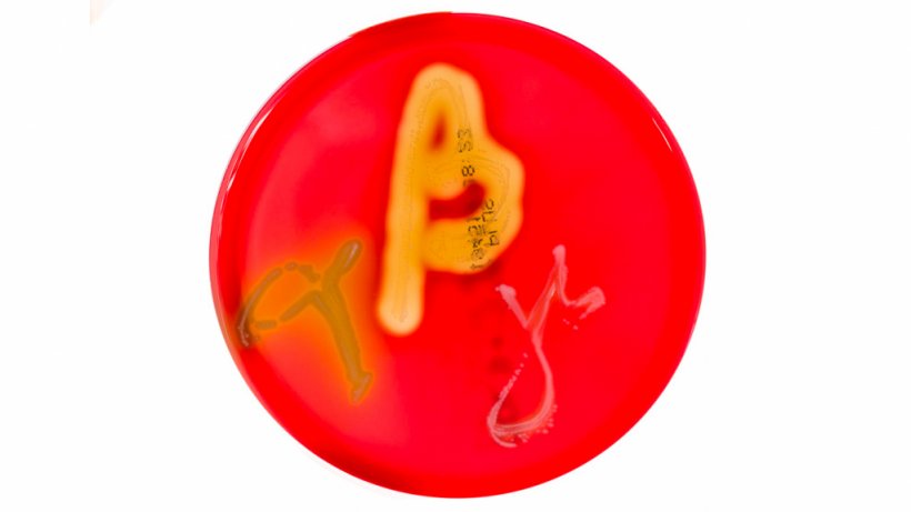 Ryc. 1. Hodowle na szalkach Petriego na agarze z krwią wykazujące hemolizę alfa, beta i gamma. Źr&oacute;dło:&nbsp;Mibilehr https://creativecommons.org/licenses/by-sa/4.0/deed.ene&nbsp;
